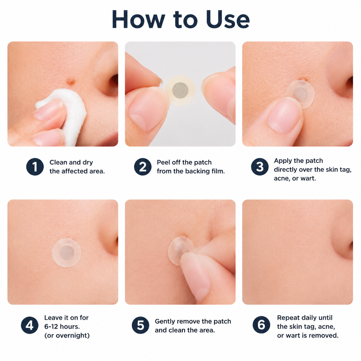 ✨Curalona®2-in-1 Microneedle & Hydrocolloid Patch🍀| Removes Raised Moles, Acne, Flat Warts & Skin Tags | Helps Improve Wrinkles, Scars & Blemishes | Invisible Patches for Face & Body