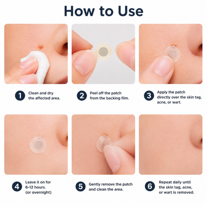 ✨Curalona®2-in-1 Microneedle & Hydrocolloid Patch🍀| Removes Raised Moles, Acne, Flat Warts & Skin Tags | Helps Improve Wrinkles, Scars & Blemishes | Invisible Patches for Face & Body