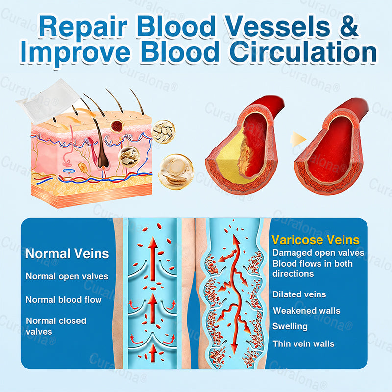 🇬🇧👨‍⚕️✅💙Curalona® VeinRepair Microneedle Patch Roll⚡Instant Relief, Long-Term Results