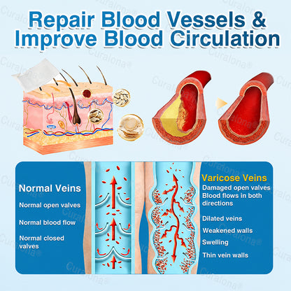 🇬🇧👨‍⚕️✅💙Curalona® VeinRepair Microneedle Patch Roll⚡Instant Relief, Long-Term Results