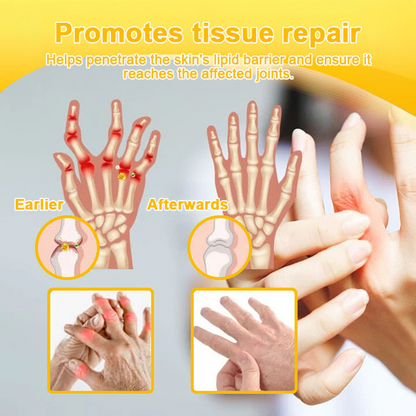 Purelora® Cream with Botulinum Toxin and Bee Venom for Pain Relief and Bone Regeneration