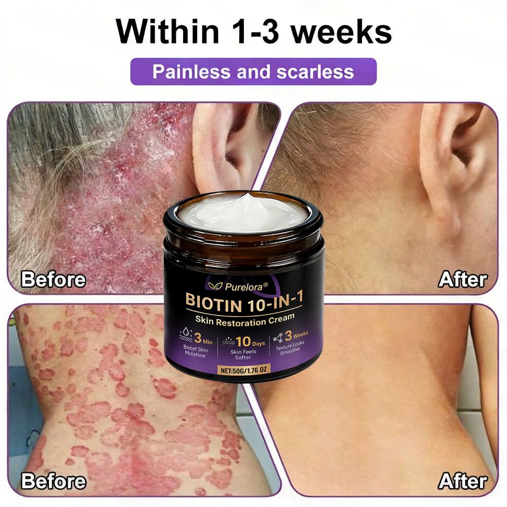 Made and Shipped from the UK 🍁 Purelora® Biotin 10-in-1 Skin Repair Cream — Last Day of Sale: 75% Off