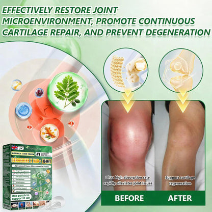Official UK Store  | 🧑‍⚕️🩺 Curalona® Moringa · Berberine × NAD+ 𝟏𝟎-𝐢𝐧-𝟏 𝐀𝐝𝐯𝐚𝐧𝐜𝐞𝐝 𝐍𝐚𝐧𝐨 𝐌𝐢𝐜𝐫𝐨𝐧𝐞𝐞𝐝𝐥𝐞 𝐏𝐚𝐭𝐜𝐡 — 𝐎𝐧𝐜𝐞 𝐃𝐚𝐢𝐥𝐲, 𝐕𝐢𝐬𝐢𝐛𝐥𝐞 𝐑𝐞𝐬𝐮𝐥𝐭𝐬 𝐢𝐧 𝟕 𝐃𝐚𝐲𝐬