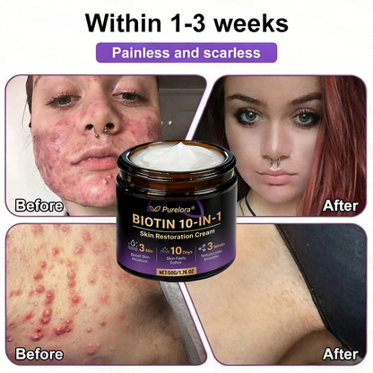 Made and Shipped from the UK 🍁 Purelora® Biotin 10-in-1 Skin Repair Cream — Last Day of Sale: 75% Off