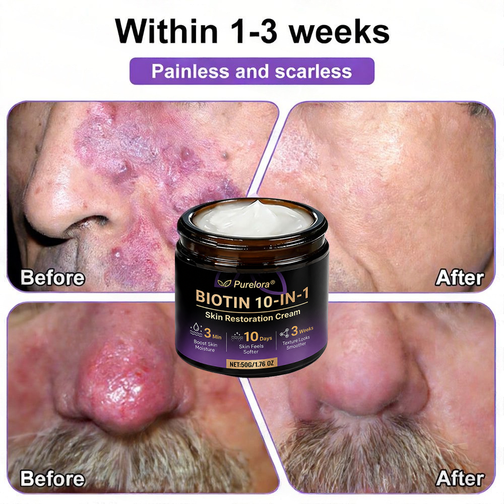Made and Shipped from the UK 🍁 Purelora® Biotin 10-in-1 Skin Repair Cream — Last Day of Sale: 75% Off