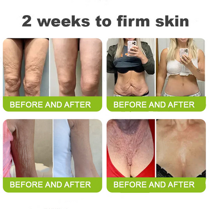 👍🌟🌿Curalona® Wrinkle-Lift Tightening cream - Last Day Promotion 70% OFF