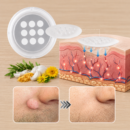 ✨Curalona®2-in-1 Microneedle & Hydrocolloid Patch🍀| Removes Raised Moles, Acne, Flat Warts & Skin Tags | Helps Improve Wrinkles, Scars & Blemishes | Invisible Patches for Face & Body