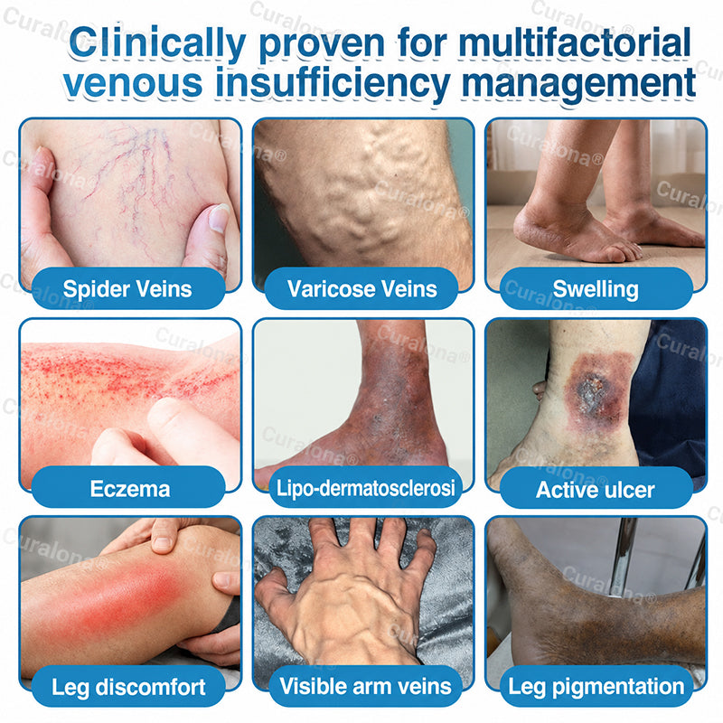 🇬🇧👨‍⚕️✅💙Curalona® VeinRepair Microneedle Patch Roll⚡Instant Relief, Long-Term Results