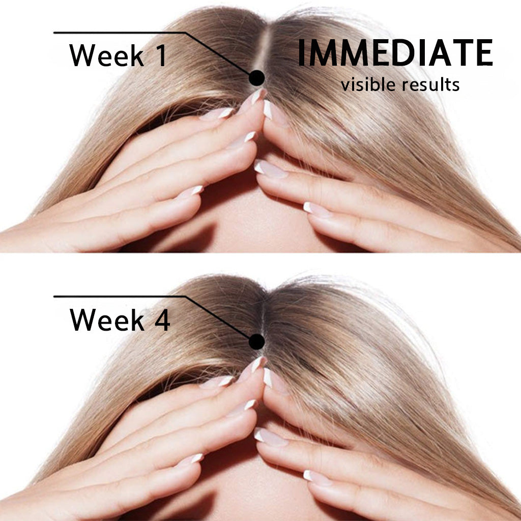 🌿👨‍⚕️ Official UK Flagship Store 🇬🇧 | 🔥PURELORA® Onion & Rosemary 2-in-1 Anti-Hair Loss & Growth Set — Infused with a 15x potent hair-growth active complex to help you achieve thicker, fuller, and stronger hair.