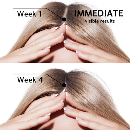 🌿👨‍⚕️ Official UK Flagship Store 🇬🇧 | 🔥PURELORA® Onion & Rosemary 2-in-1 Anti-Hair Loss & Growth Set — Infused with a 15x potent hair-growth active complex to help you achieve thicker, fuller, and stronger hair.